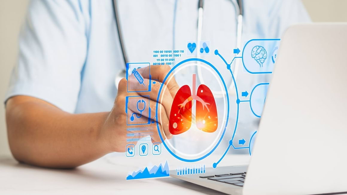 Tratamentul cancerului bronho-pulmonar cu celule mici