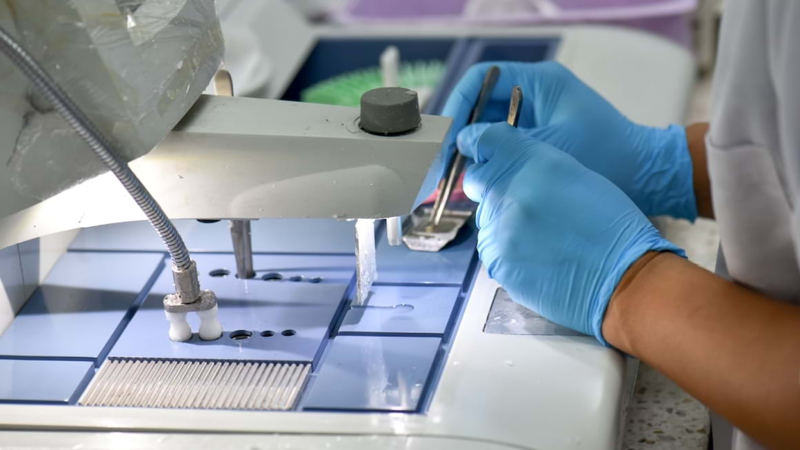 Biopsia pentru psoriazis: când și de ce este necesară?