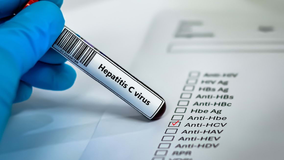 Diagnosticarea Hepatitei C