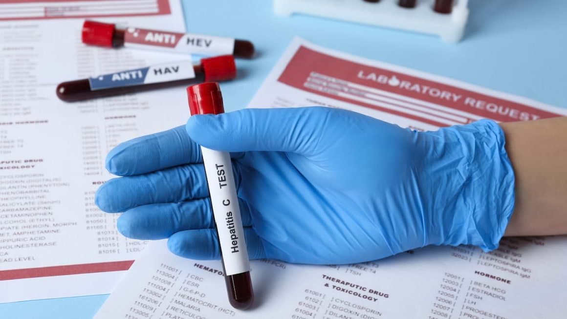 Hepatita C: genotiparea virusului hepatitic C
