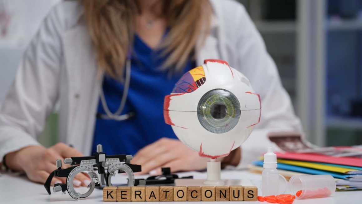 Keratoconusul: ce probleme de vedere provoaca si cum se trateaza?