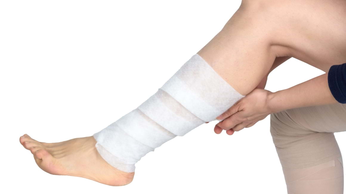 Limfedemul, o complicatie frecventa in oncologie