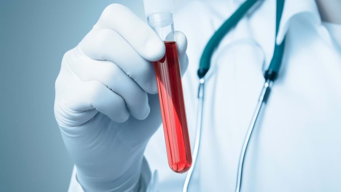 Un nou test de sange poate detecta precoce cancerul mamar?