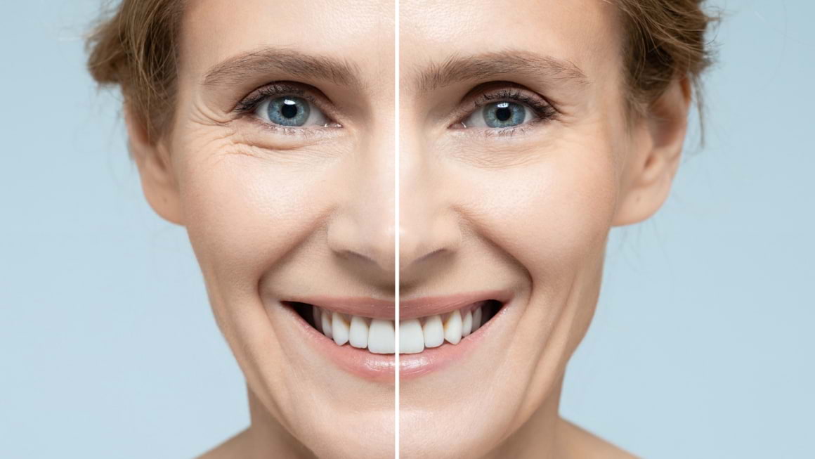 Ce impact are stresul oxidativ asupra procesului natural de îmbătrânire a pielii