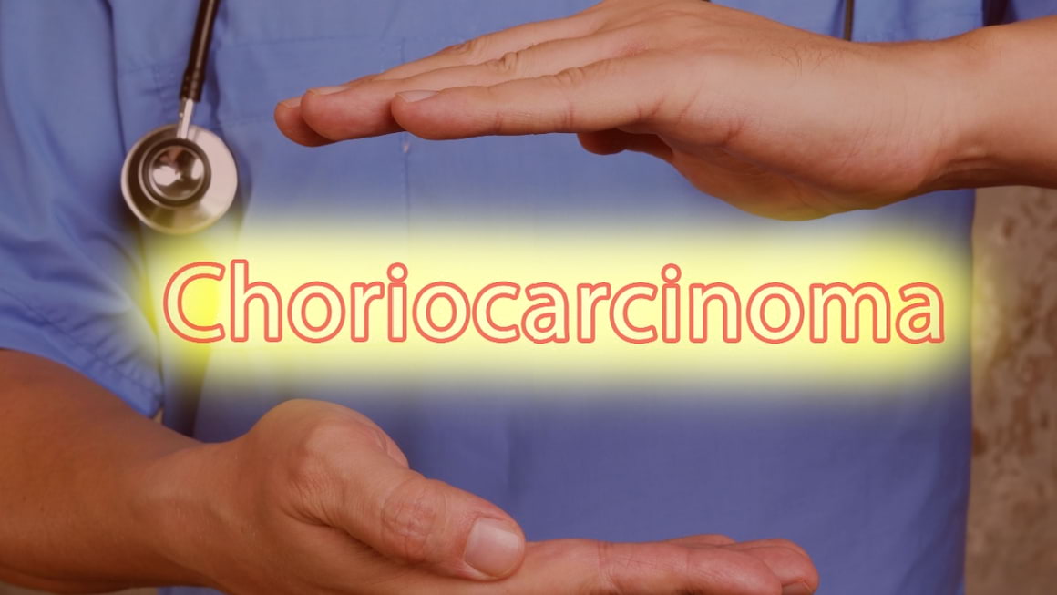 Coriocarcinom: ce este și cum se tratează?
