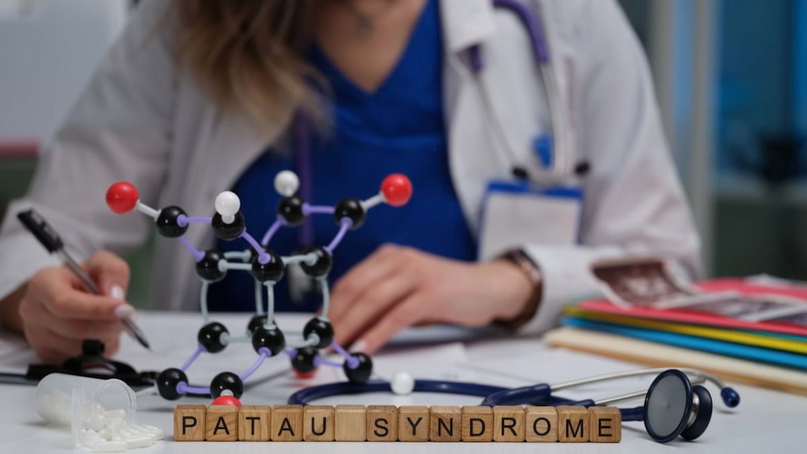 Totul despre sindromul Patau (trisomia 13)