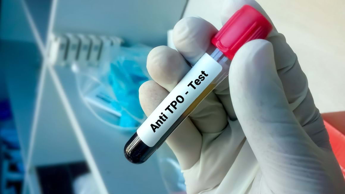 Analiza anti-TPO: ce este și ce boli semnalează?
