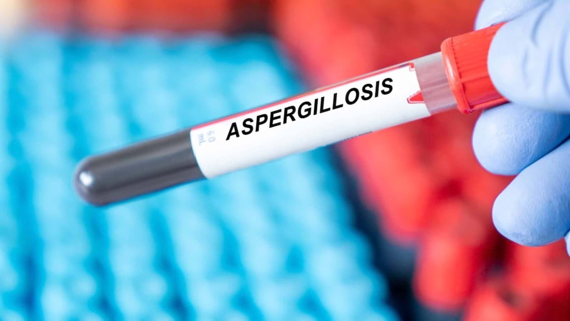 Aspergiloza: cauze, simptome, diagnostic și tratament