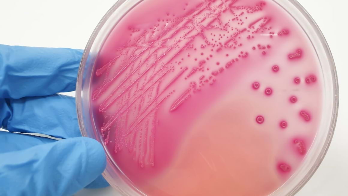 Totul despre E. coli: cum se transmite, ce afectiuni provoaca si cum poate fi prevenita