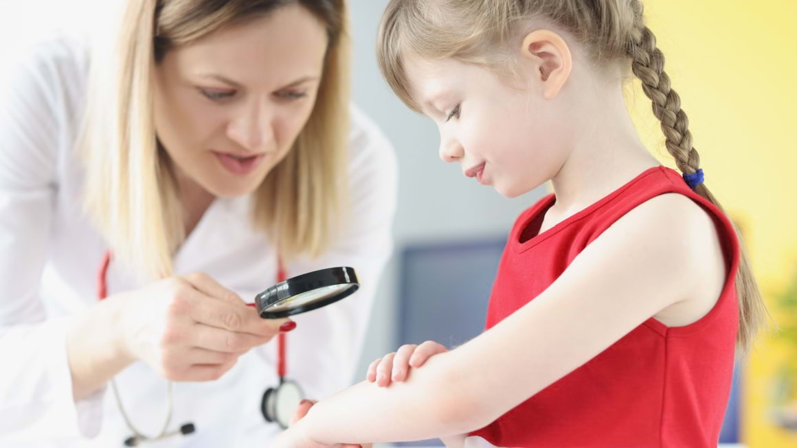 Tulburări emoționale la copiii cu psoriazis