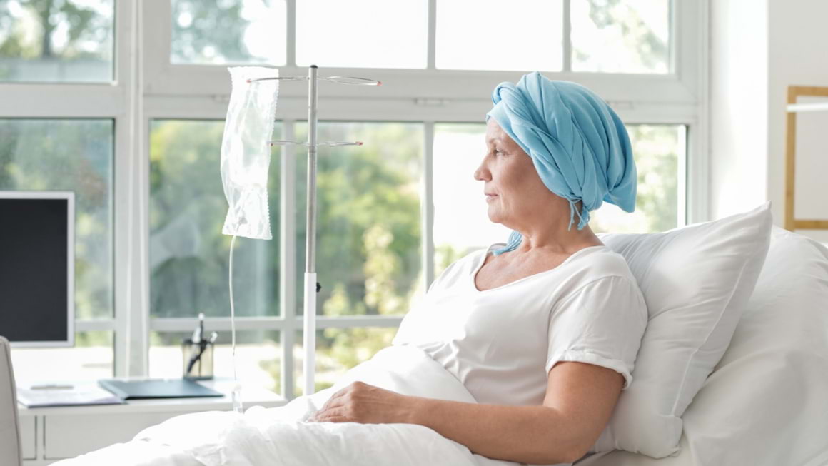 Cancerul ovarian metastatic și tratamentul cu topotecan