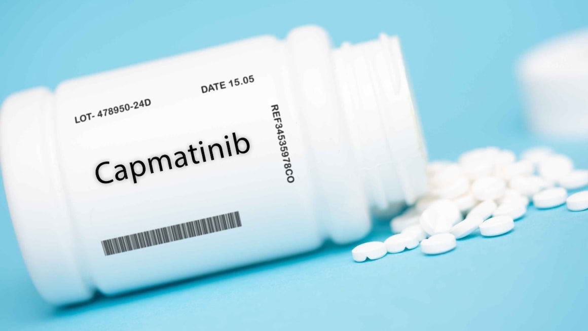 Cancerul pulmonar non-microcelular și tratamentul cu capmatinib