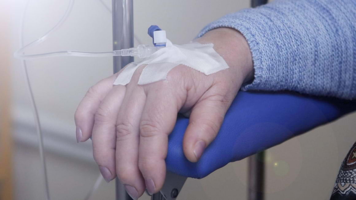 Totul despre fluorouracil