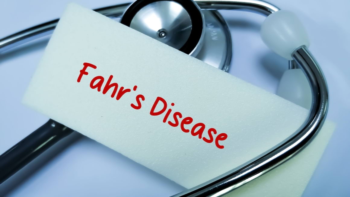 Boala Fahr (sindromul Fahr): cauze, simptome, tratament