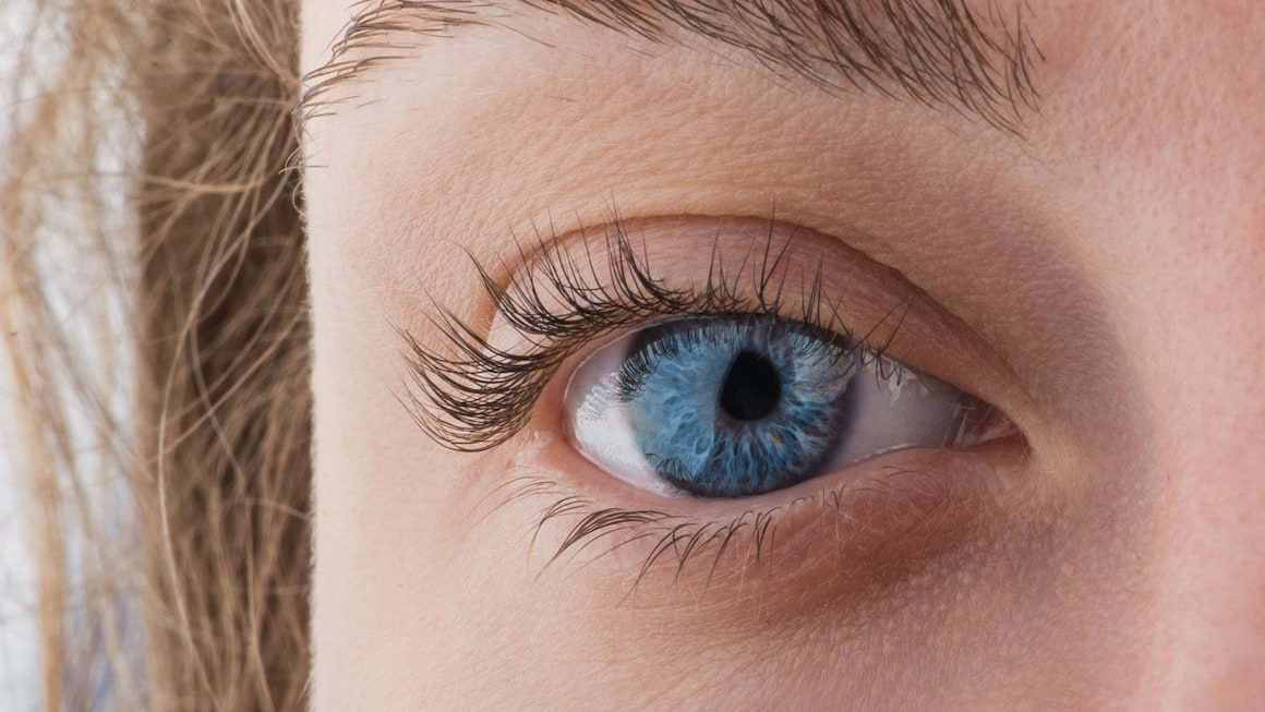Melanomul malign ocular, mai frecvent la persoanele cu ochi de culoare deschisa
