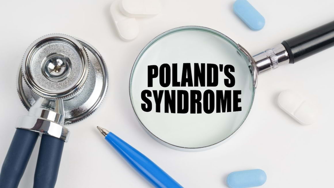 Sindromul Poland: cauze, simptome, tratament