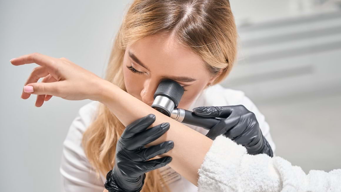 Cercetatorii australieni au descoperit cum sa impiedice raspandirea melanomului