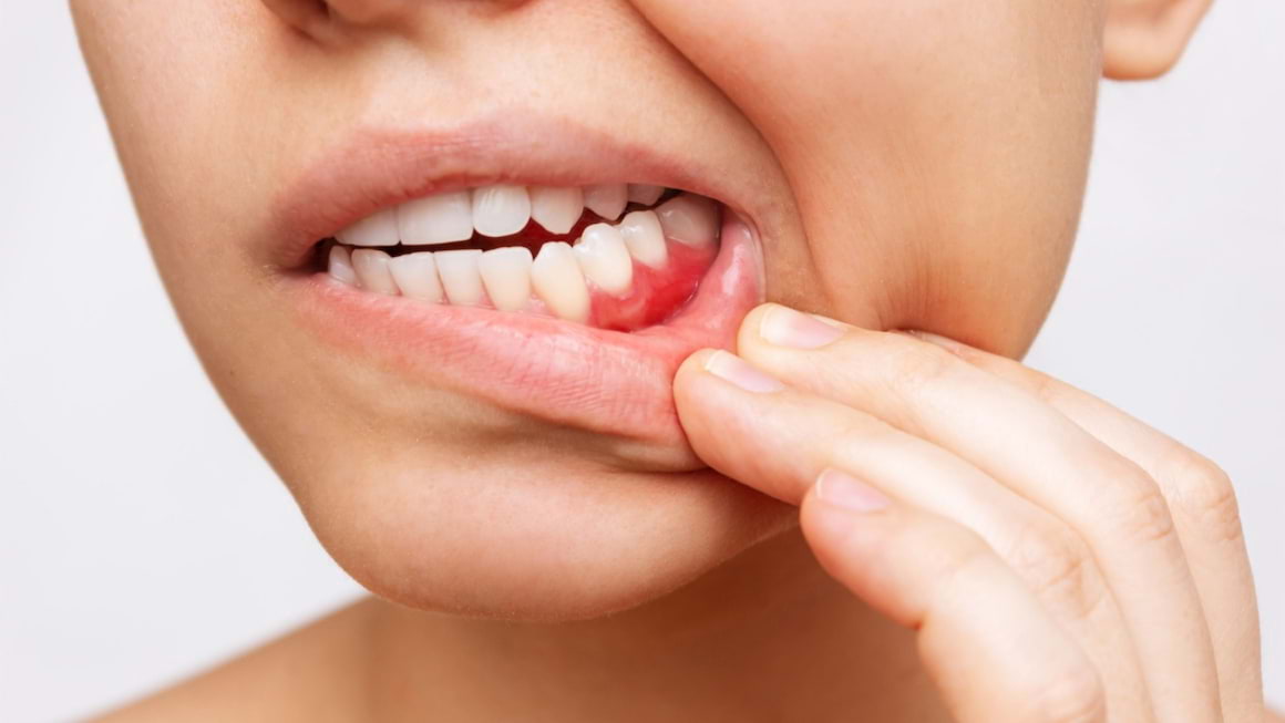 Parodontita: care sunt cele mai comune cauze ale afectării gingiilor