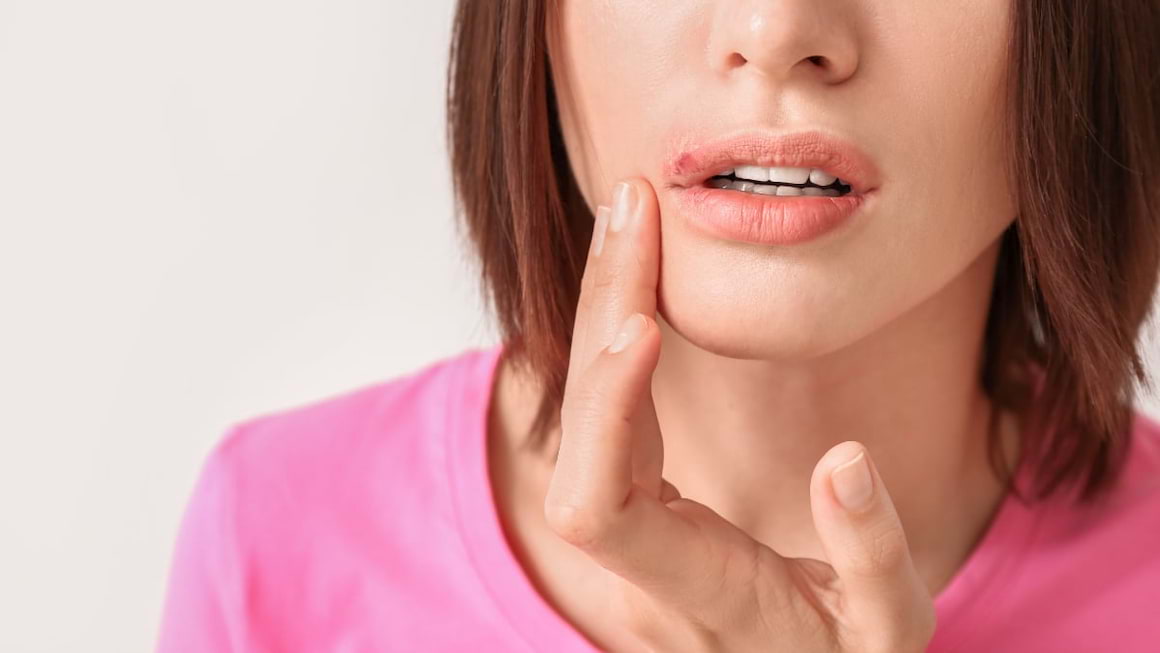 Cum tratezi corect herpesul? Antivirale și remedii naturale