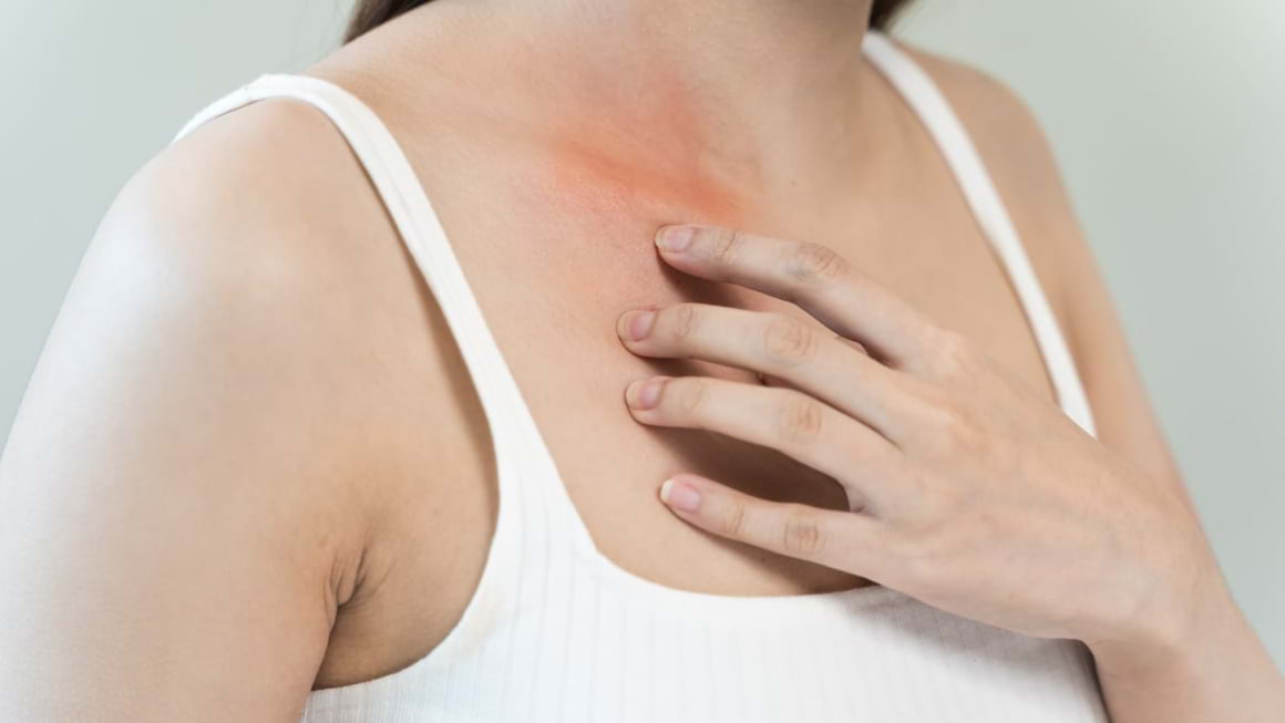 Înroșirea pielii: cauze, tratament, prevenire