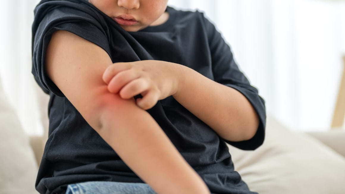 Tot ce trebuie să știi despre artrita psoriazică la copii
