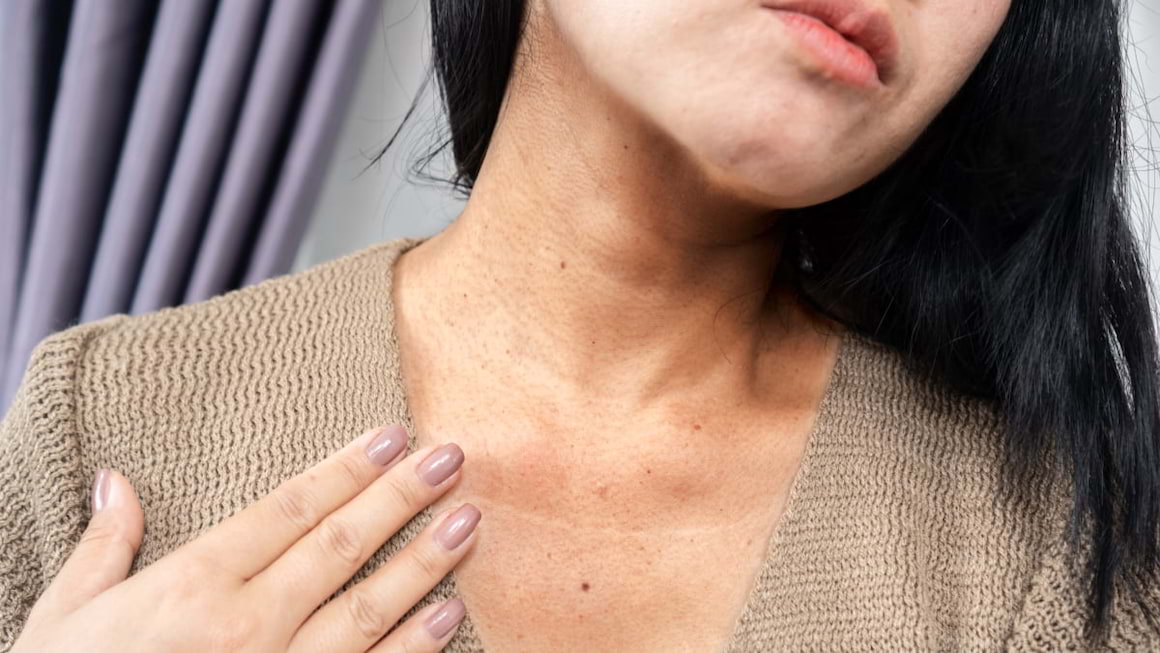 Acanthosis nigricans, petele negre de pe piele care pot semnala diabet