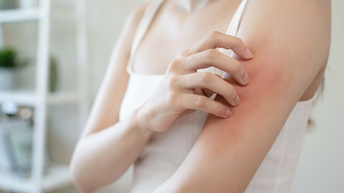 Ce este eczema: tipuri și tratament