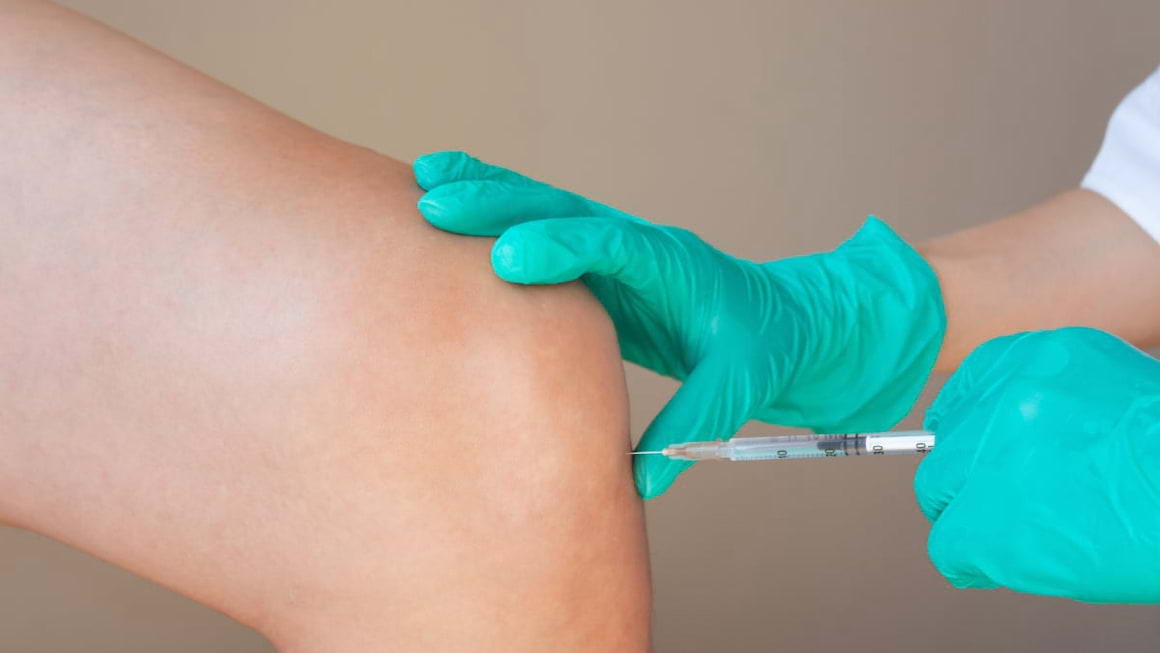 Cum ajuta injectiile cu acid hialuronic in gonartroza?