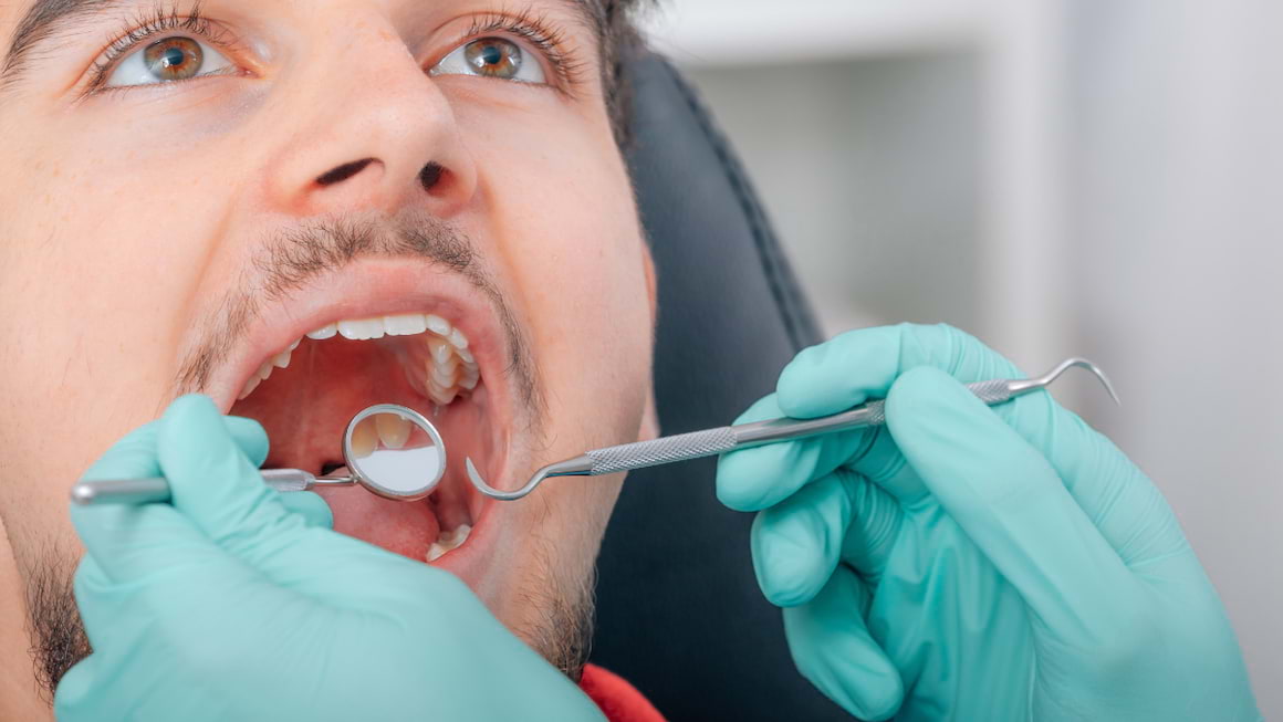 Carcinomul de mucoasa: un motiv in plus de a merge la stomatolog