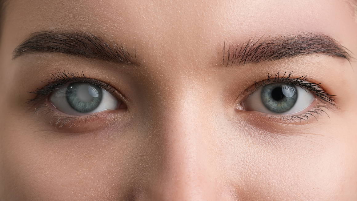 7 lucruri pe care trebuie sa le stii despre glaucom