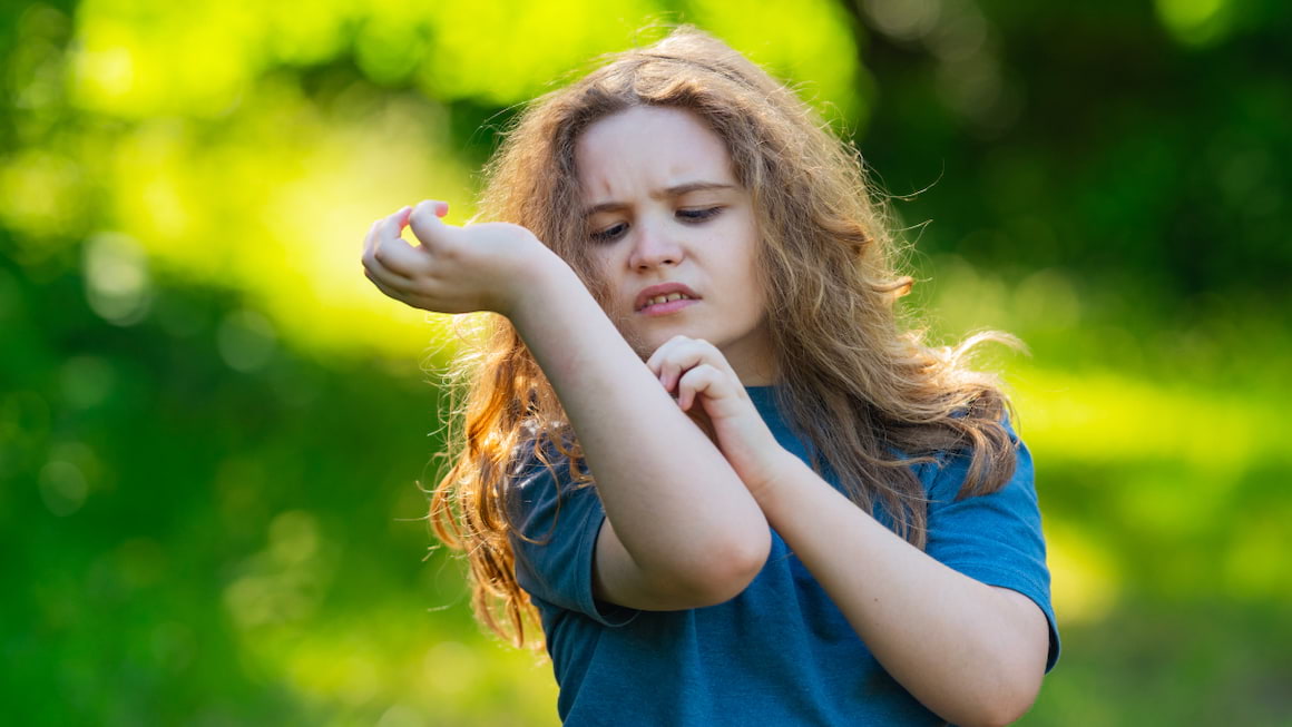 Dermatita atopica la copii- cauze, tratament, prevenire, dieta