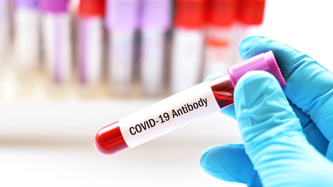 COVID-19: Standardizarea masurarii nivelului de anticorpi