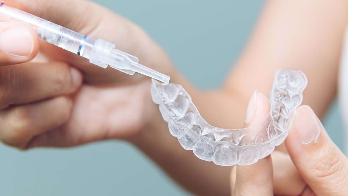 Ce efect are albirea dintilor asupra smaltului dentar?