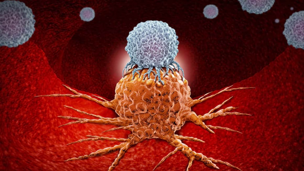 Un medicament experimental, promitator in tratarea cancerului de vezica urinara