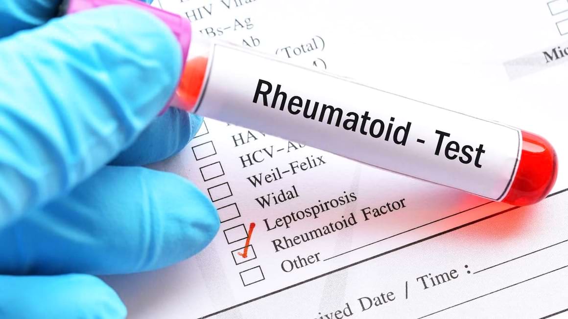 Factorul Reumatoid: Ce este? Cum se masoara si ce boli indica