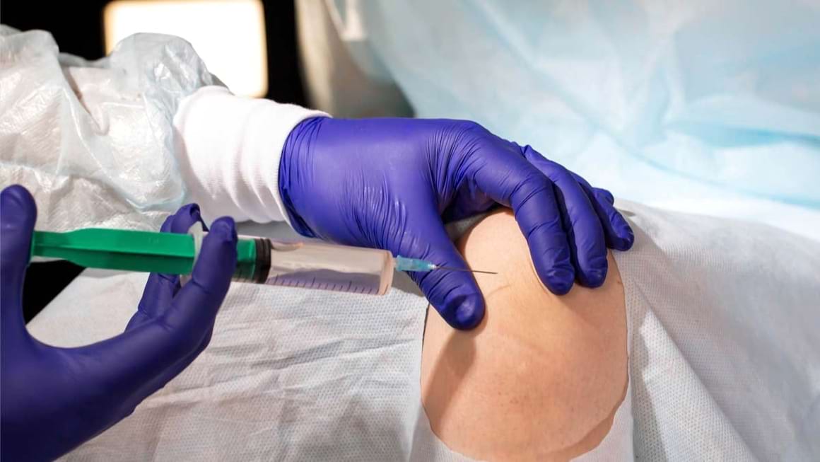 Terapia intraarticulara si terapia topica in gonartroza