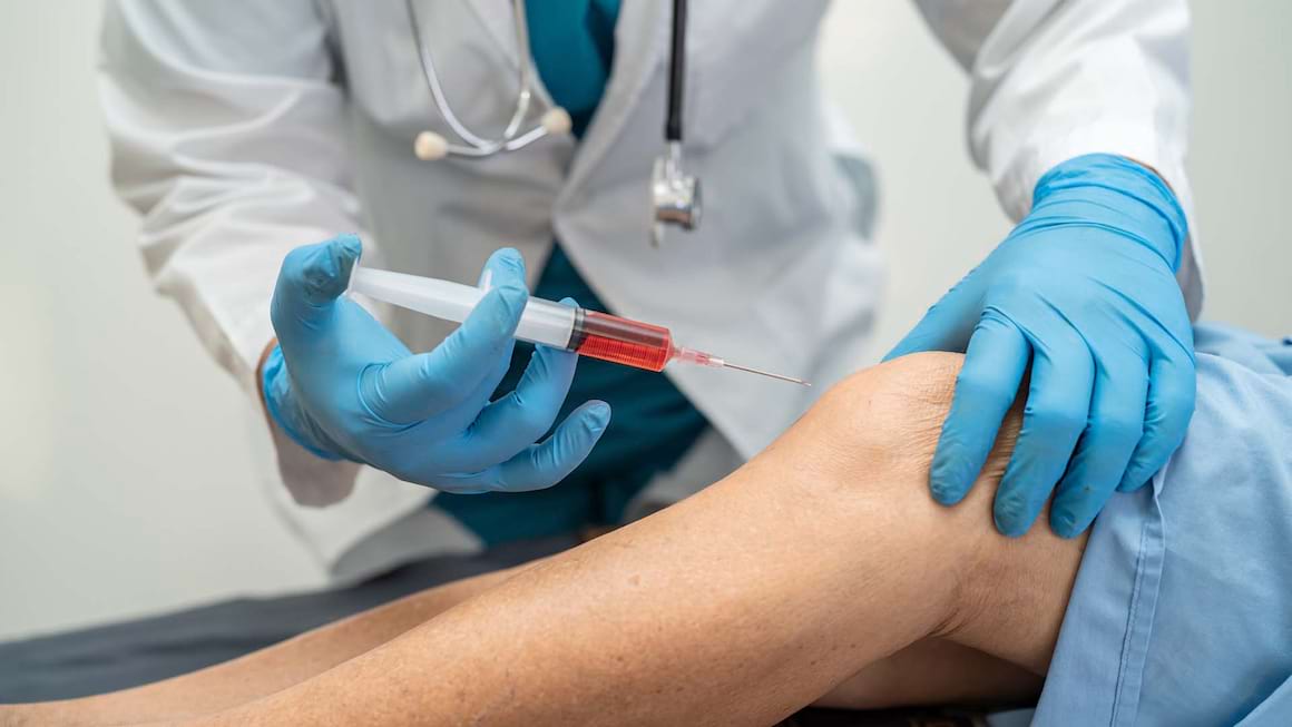 Tratamentul intraarticular pentru gonartroza