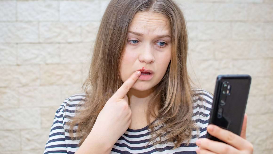 Ce legatura este intre herpes si bolile neurodegenerative?