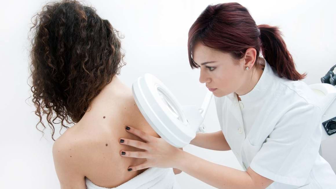 Tot ce trebuie sa stii despre melanomul malign: cauze, simptome, tratament modern