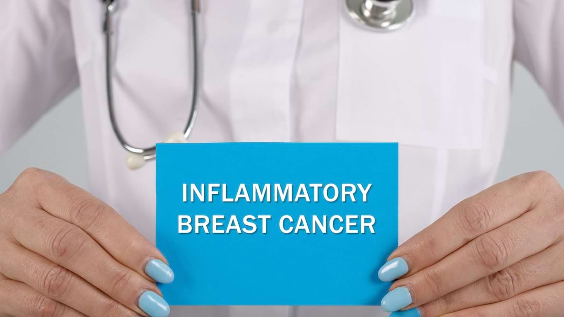 Cancerul mamar inflamator: factori de risc si diagnostic