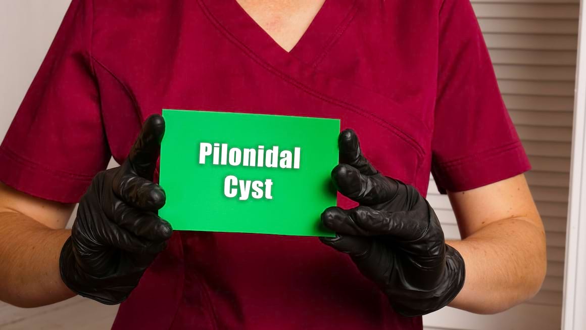 Chistul pilonidal, cosmarul barbatilor