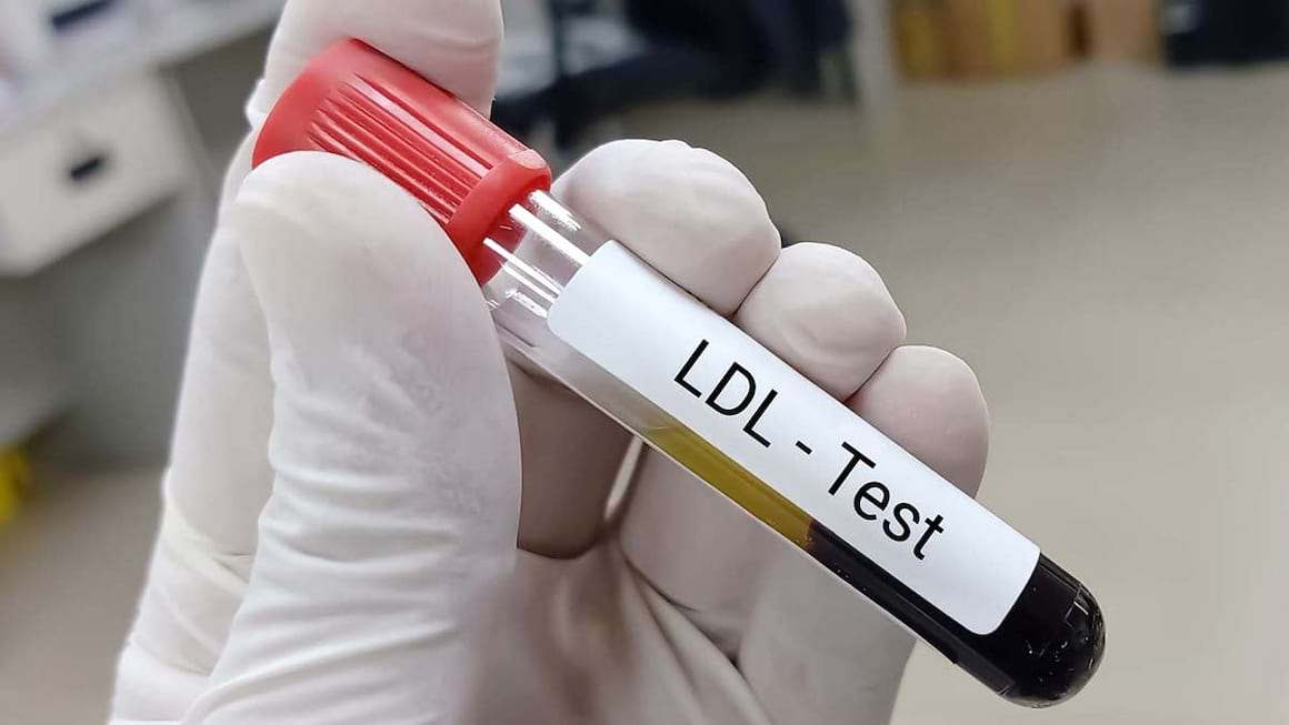 Ce diferente exista intre colesterolul LDL si VLDL?