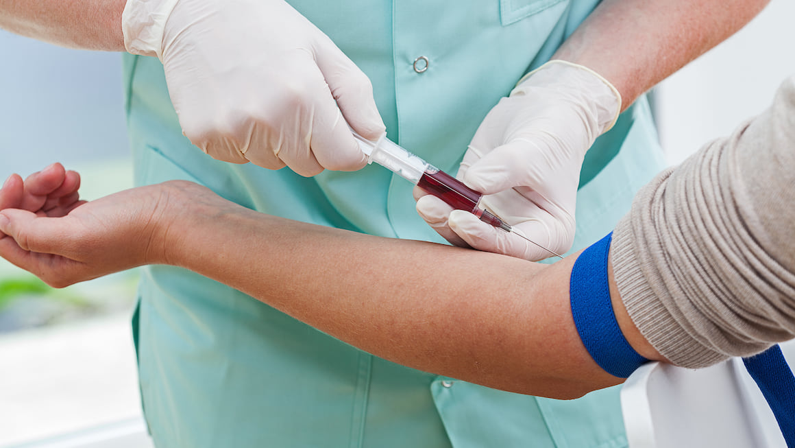 Dislipidemia: semne, diagnostic, tratament | Ce substante active ajuta