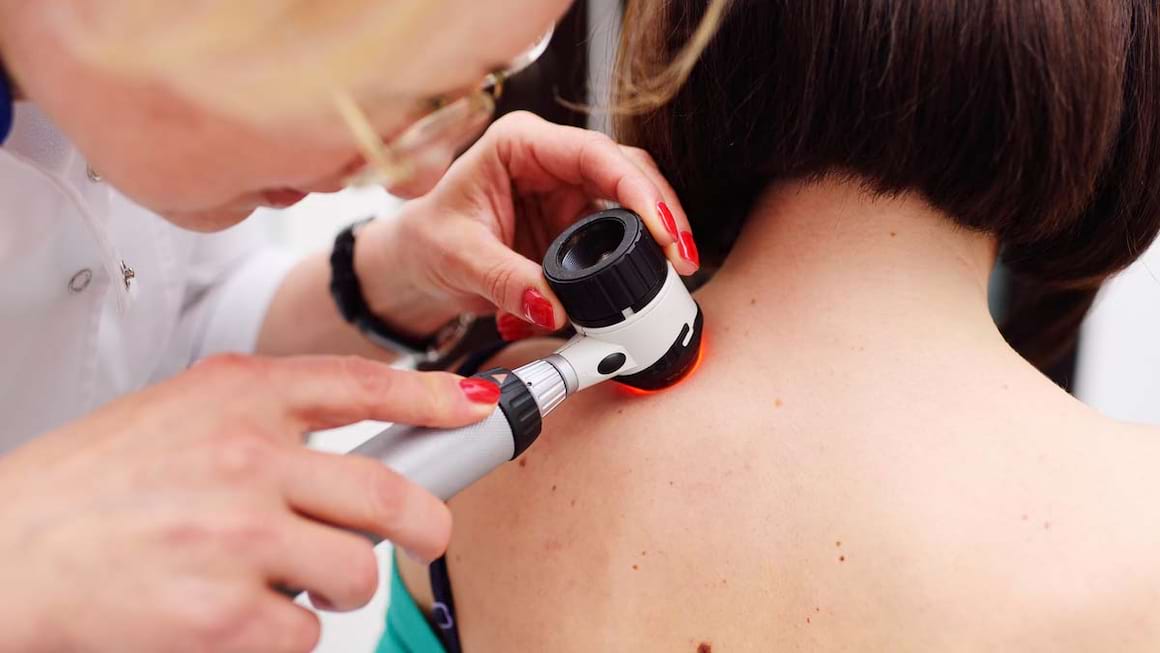Melanomul amelanotic: cauze, simptome si tratament