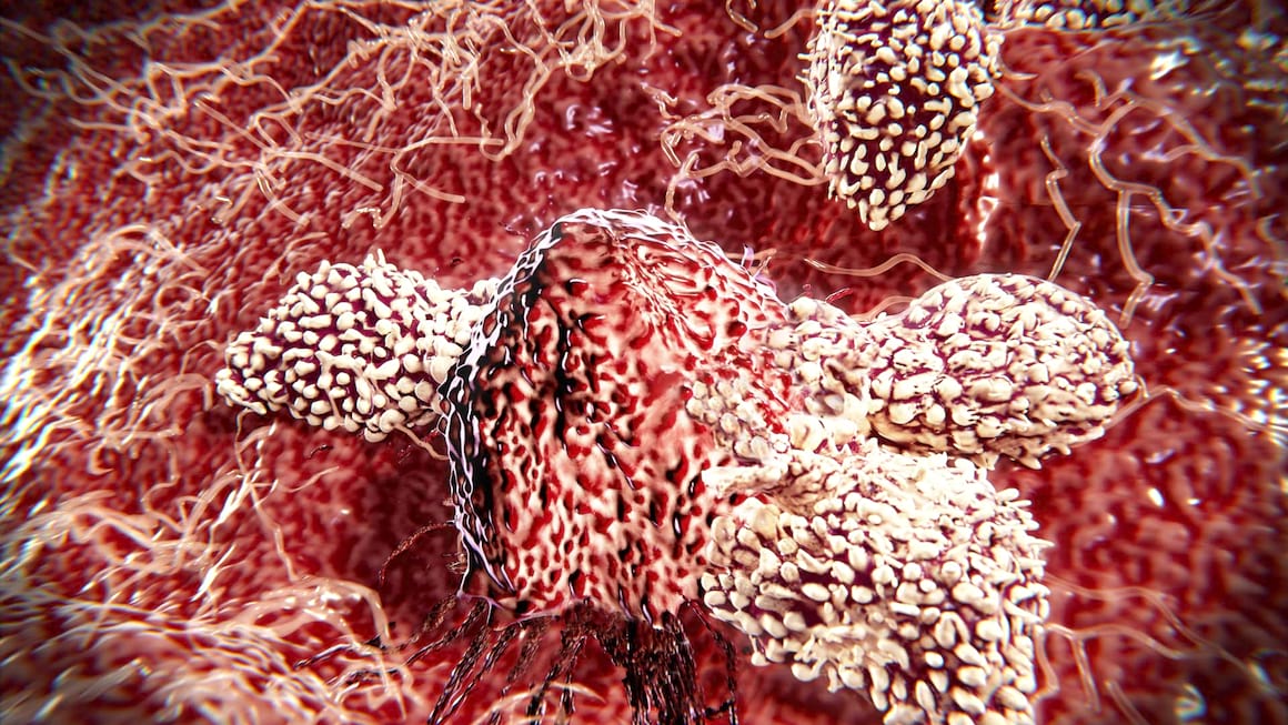 Imunoterapia in cancerele hepatobiliare, a doua cauza de deces prin cancer la nivel mondial