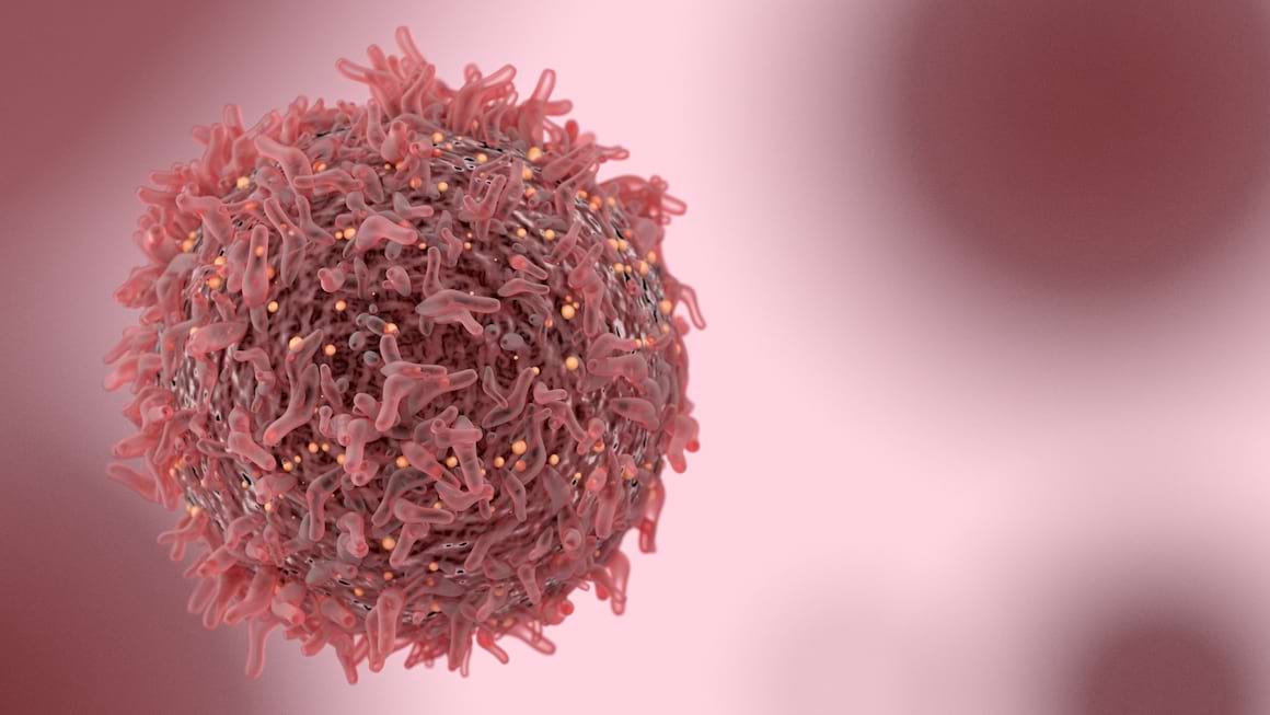 Incidenta cancerului la ficat in randul bolnavilor de ciroza