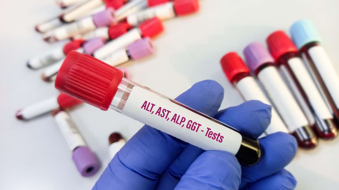 Metode uzuale de investigare a ficatului afectat de hepatita