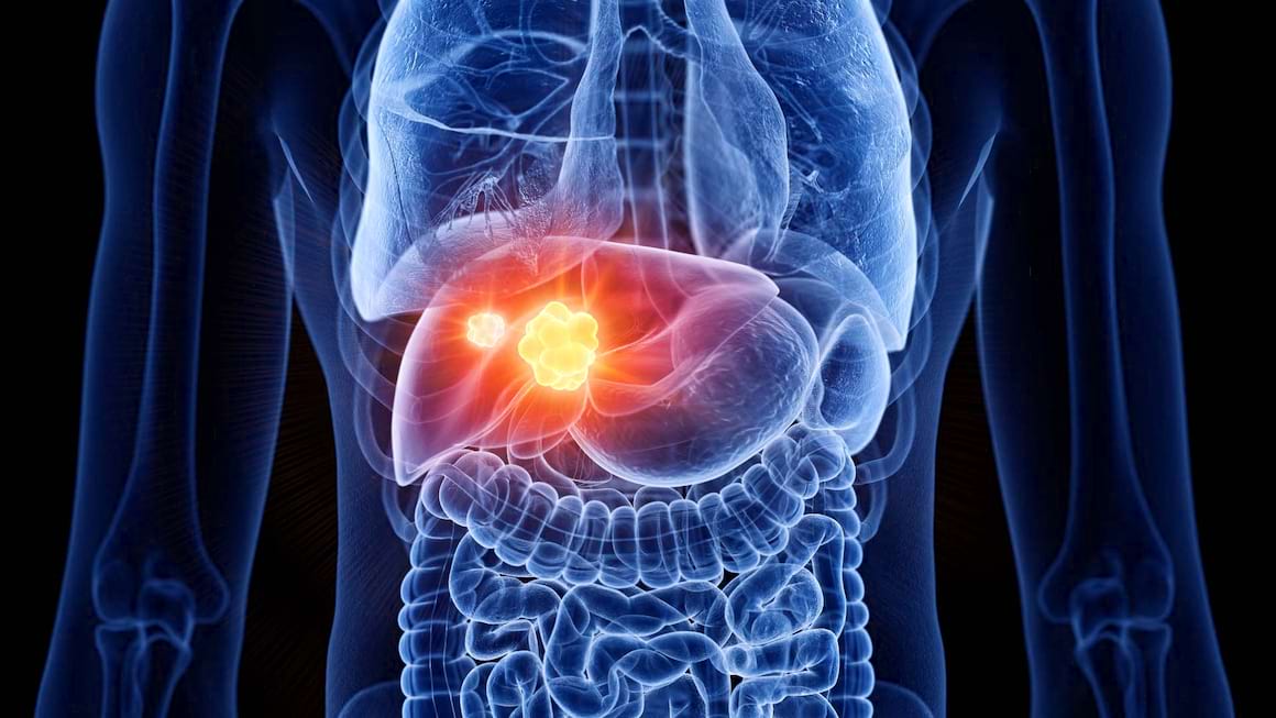 Moartea celulara fiziologica favorizeaza cancerul la ficat