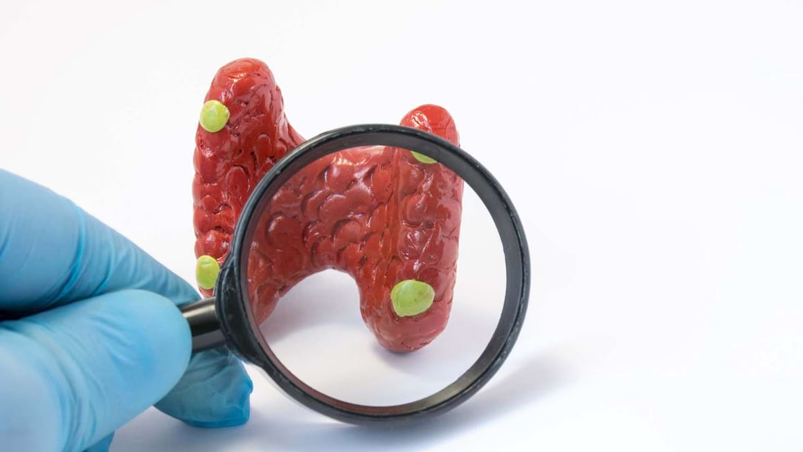 Afectiunile paratiroidei: hiperparatiroidism, hipoparatiroidism, cancer paratiroidian