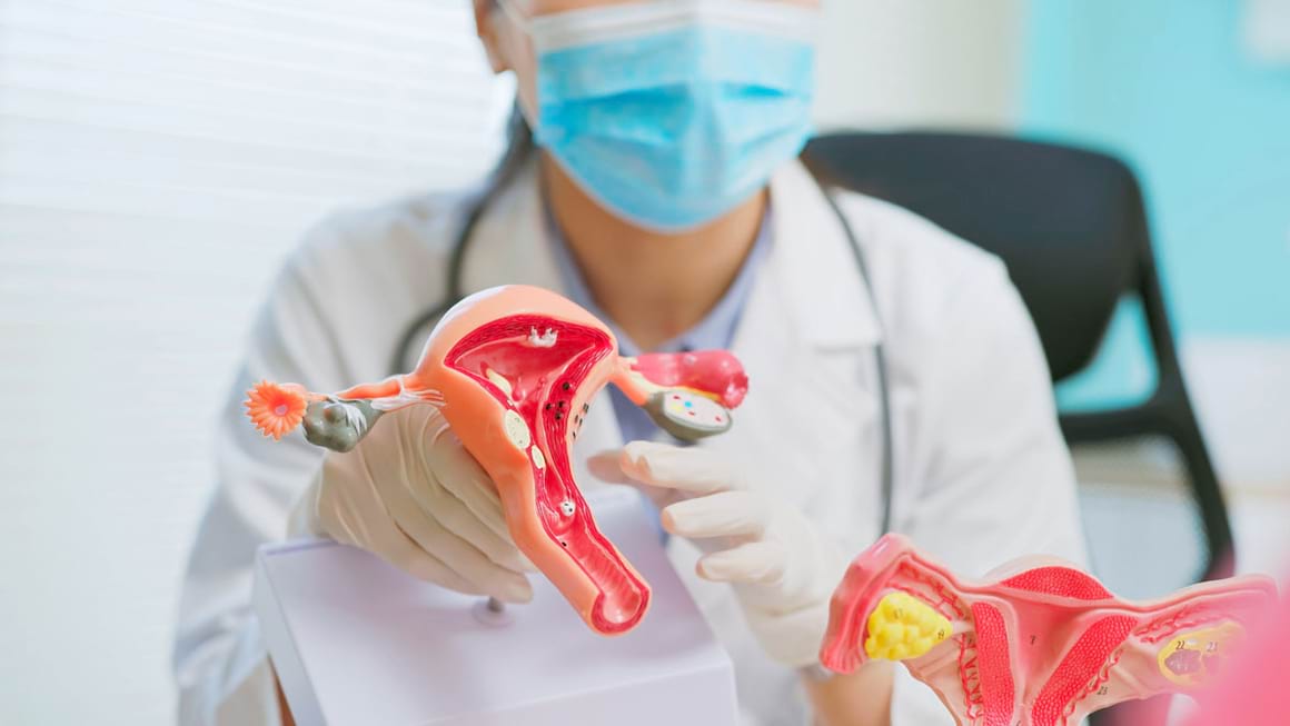 Factorii de risc si simptomele cancerului ovarian